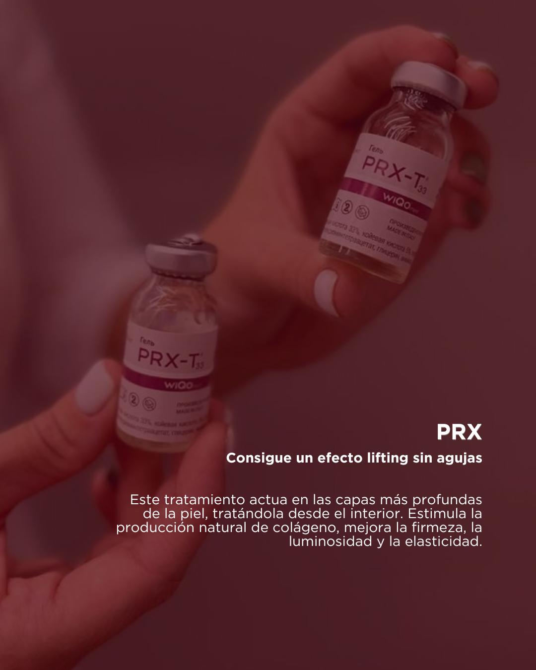 PRX-T33 – Peeling Médico Superglow