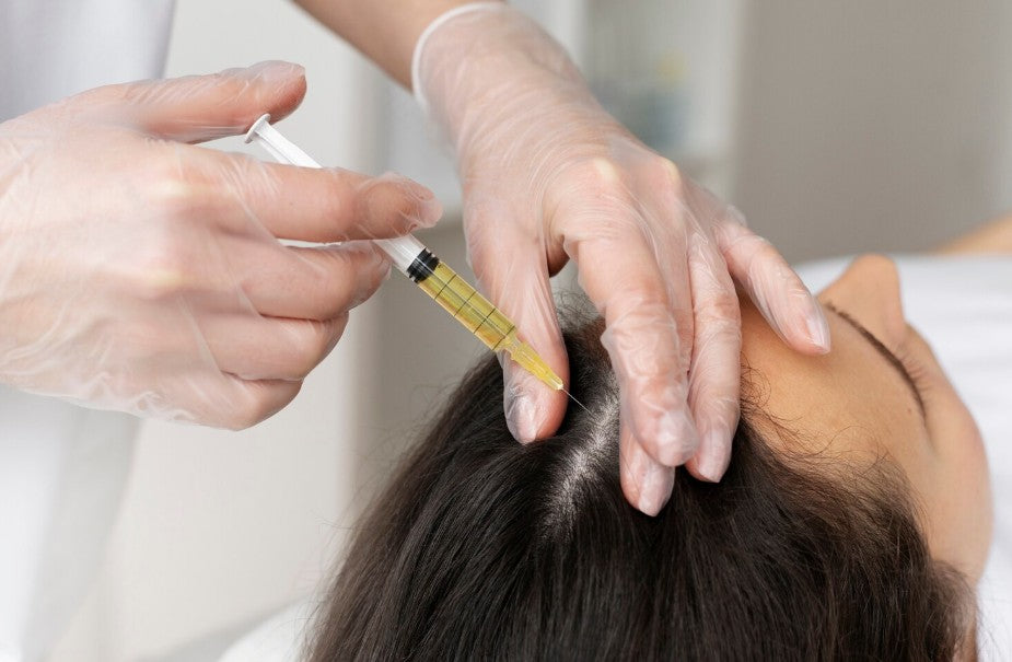 Mesoterapia Capilar