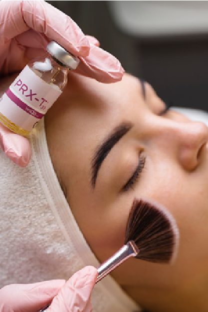 PRX-T33 – Peeling Médico Superglow